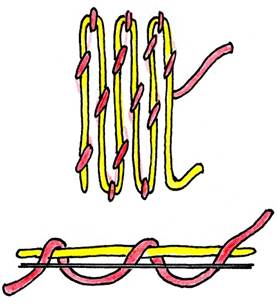 Anlegetechnik